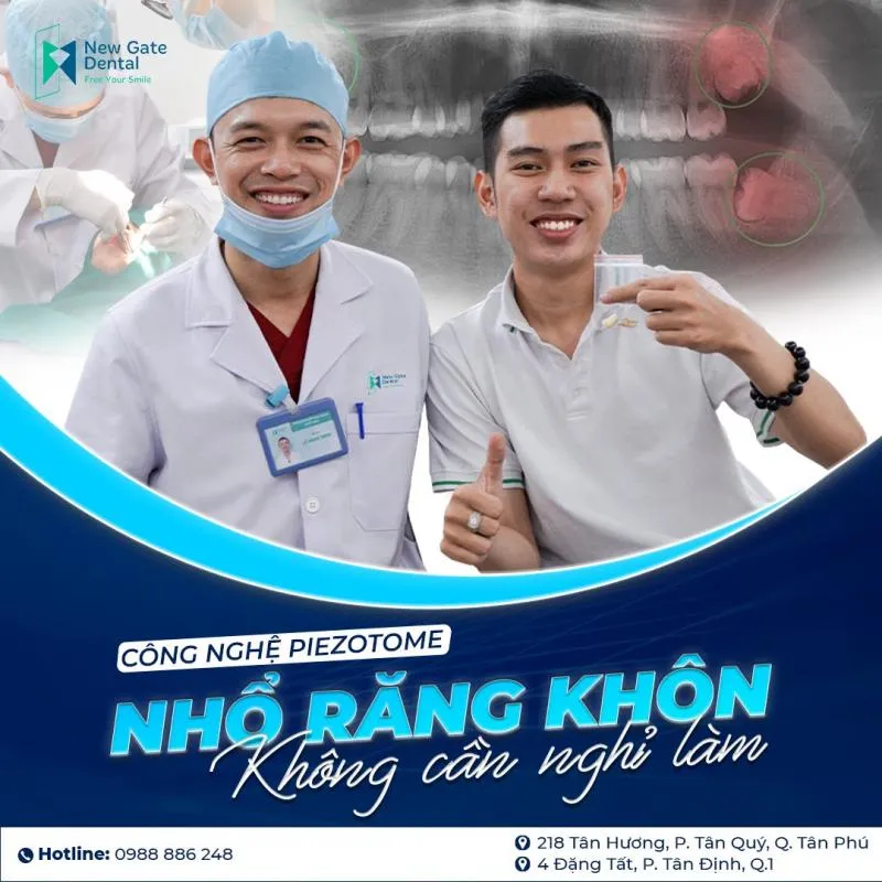 Top 10 Nha khoa nhổ răng khôn uy tín nhất quận Tân Phú, TP. HCM