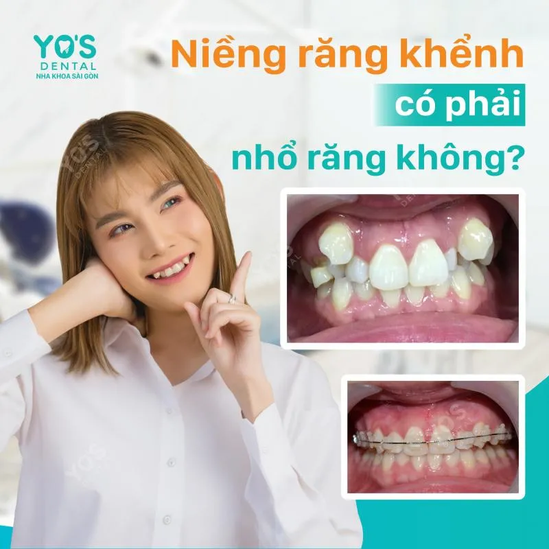 Top 10 Phòng khám nha khoa uy tín nhất tỉnh Bình Dương