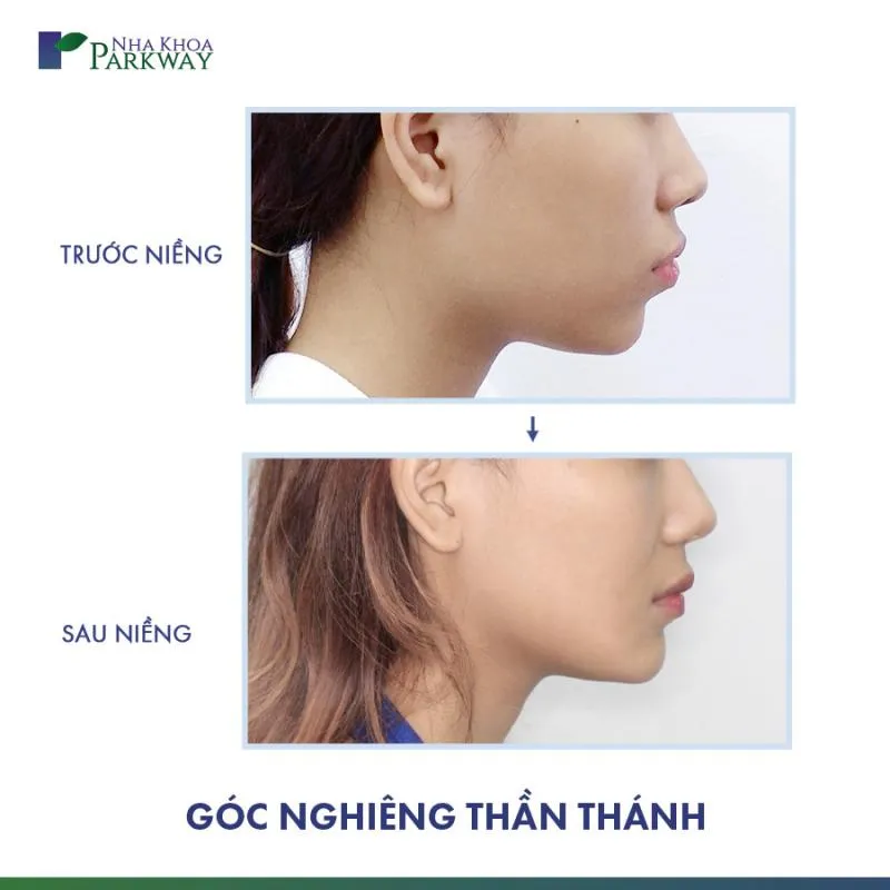 Top 10 Phòng khám nha khoa uy tín nhất tỉnh Bình Dương