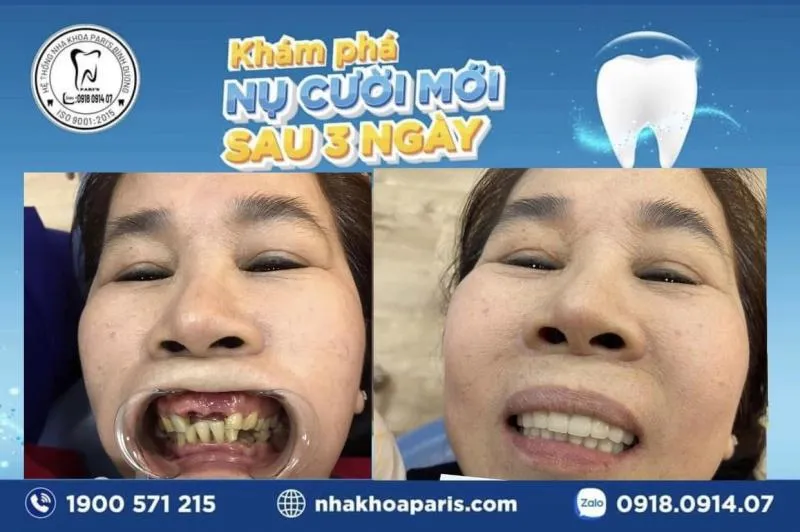 Top 10 Phòng khám nha khoa uy tín nhất tỉnh Bình Dương