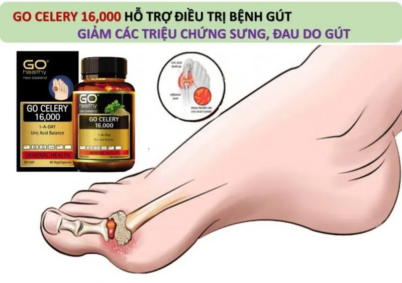 Top 10 Thực phẩm chức năng hỗ trợ điều trị bệnh Gout hiệu quả nhất hiện nay