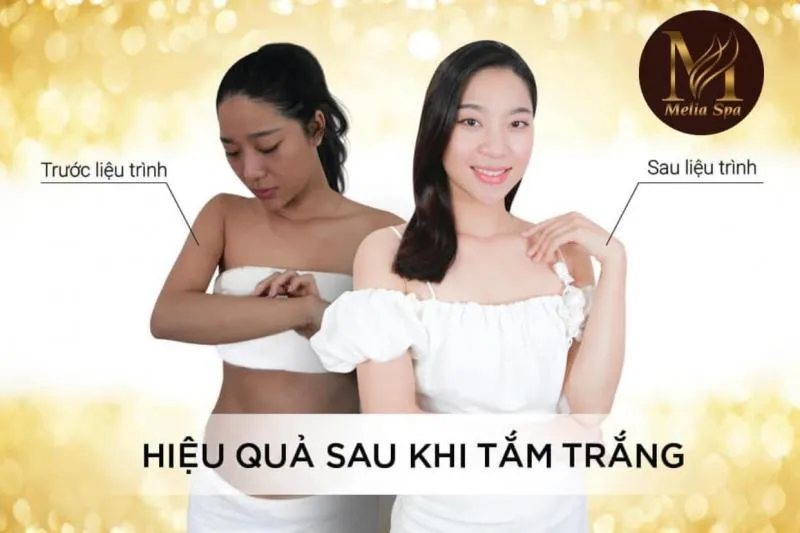 Top 3 Spa tắm trắng uy tín nhất tỉnh Hà Tĩnh