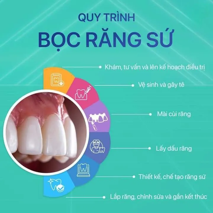 Top 8 Địa chỉ bọc răng sứ uy tín nhất tỉnh Phú Yên